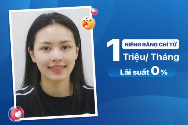 Bảng giá niềng răng mắc cài sứ tại Hà Nội mới nhất 2 nieng rang tra gop lai suat thap 599x400 1
