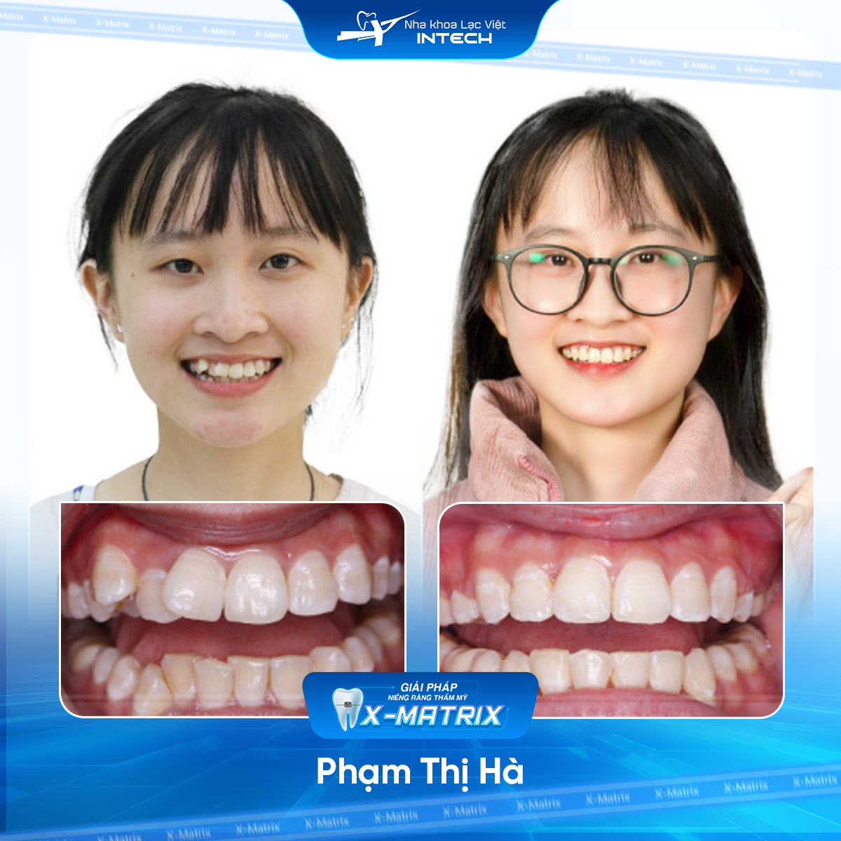 Bac si nieng rang Thu Anh nha khoa Lac Viet Intech