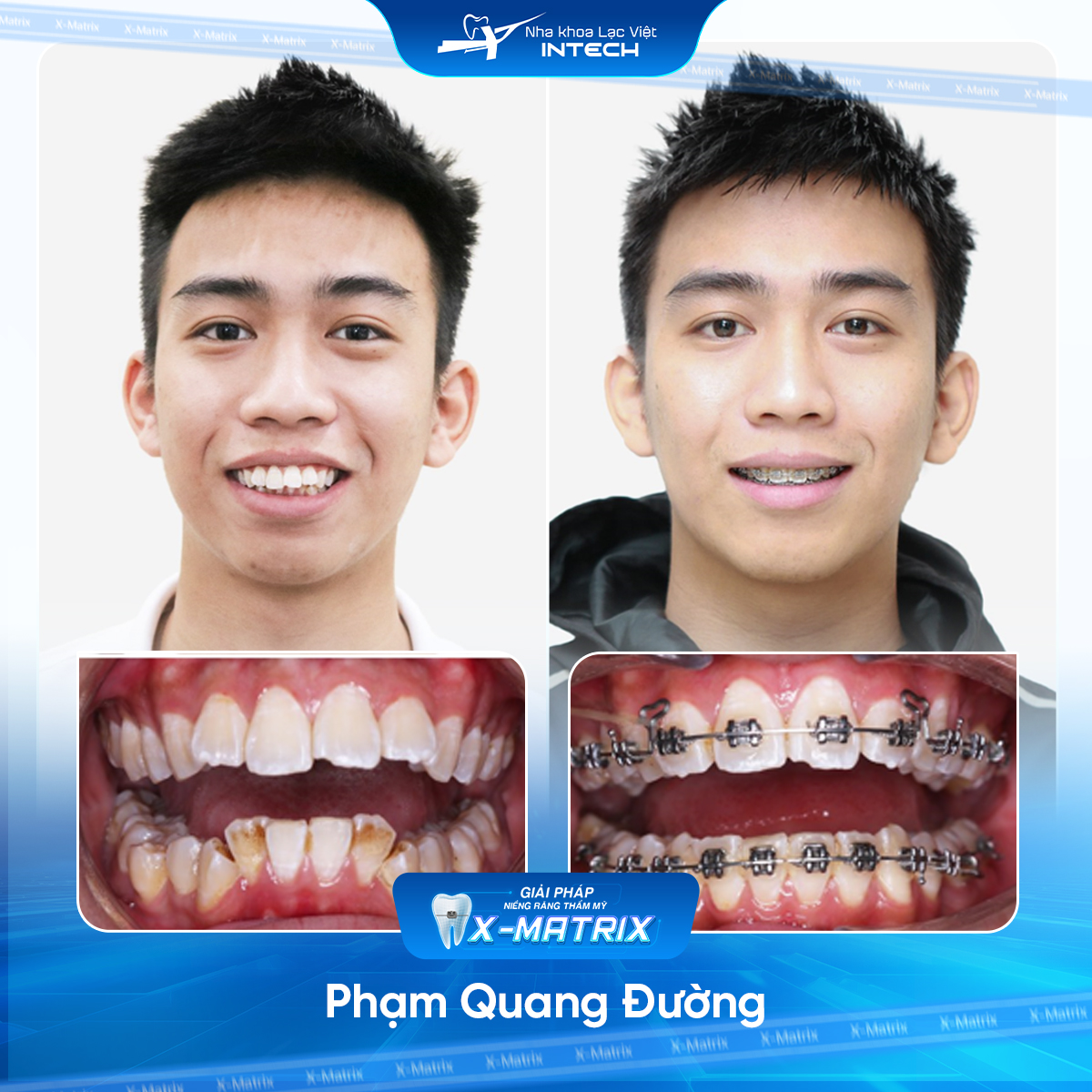 Bac si nieng rang Thu Anh nha khoa Lac Viet Intech