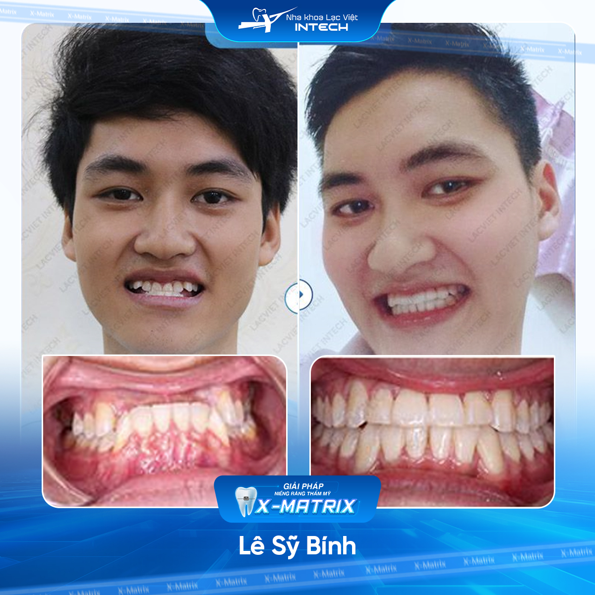 Bac si nieng rang Thu Anh nha khoa Lac Viet Intech