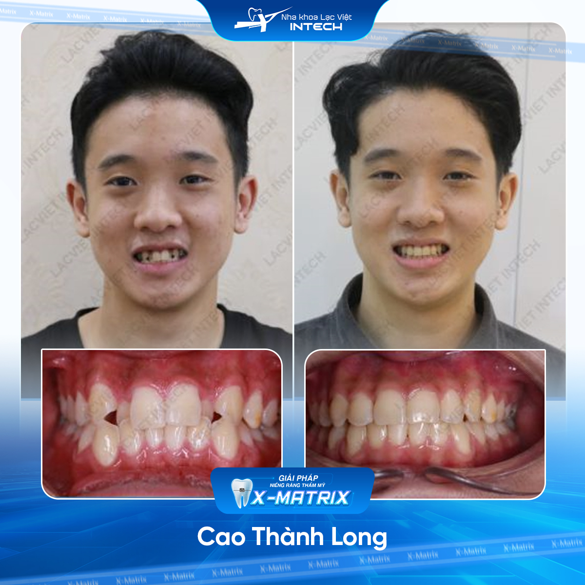 Bac si nieng rang Thu Anh nha khoa Lac Viet Intech