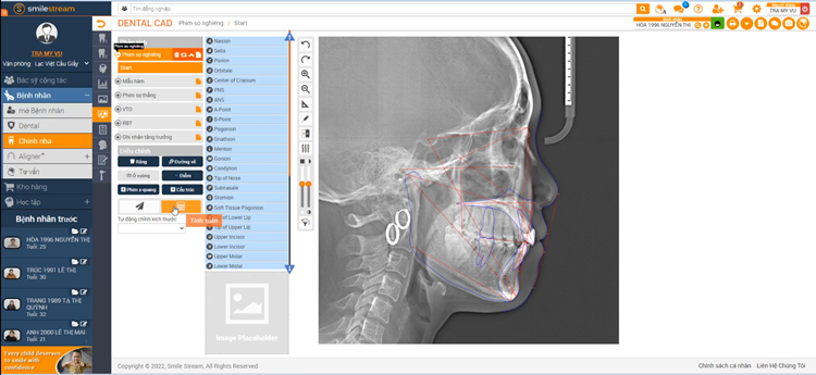 cong nghe SmileStream - x-matrix - nha khoa lac viet intech (3)